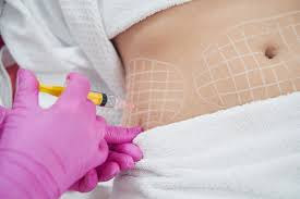 Fat Dissolve Injections