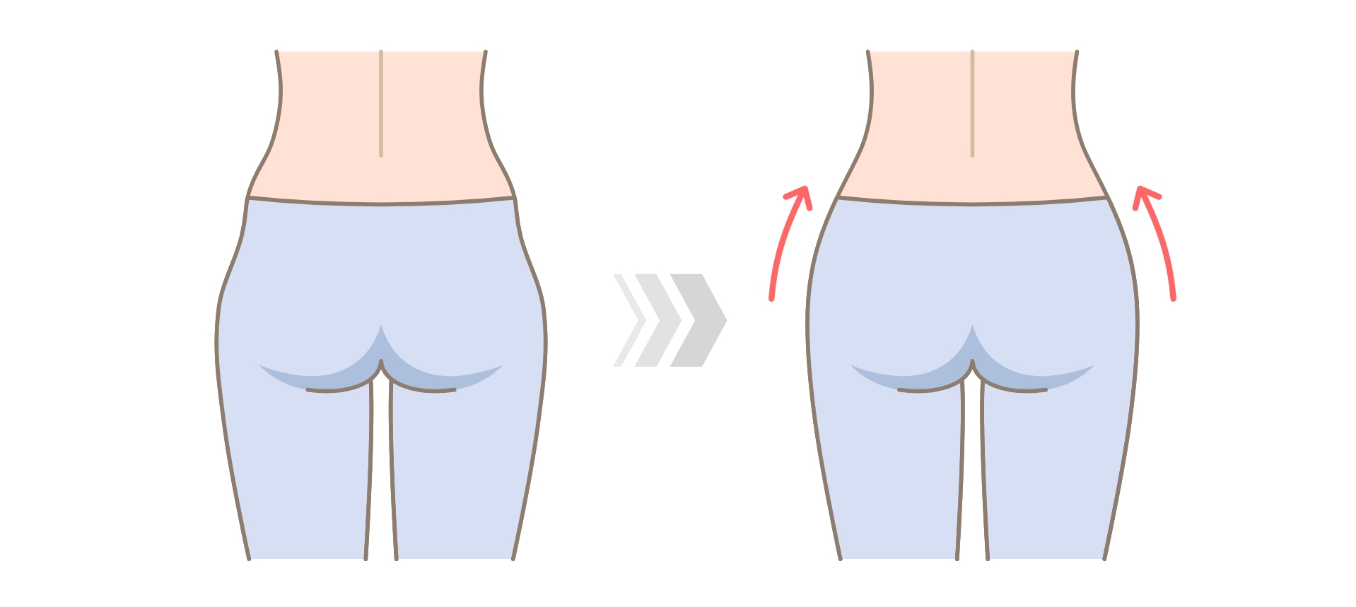 Hip Dip Correction
