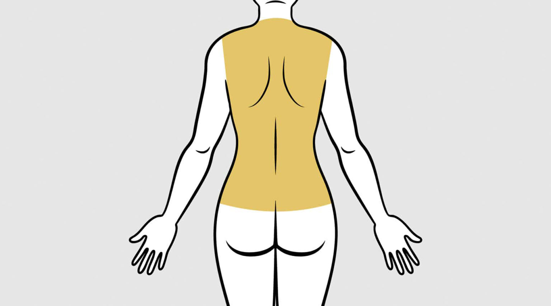 Back and Bra Roll Liposuction